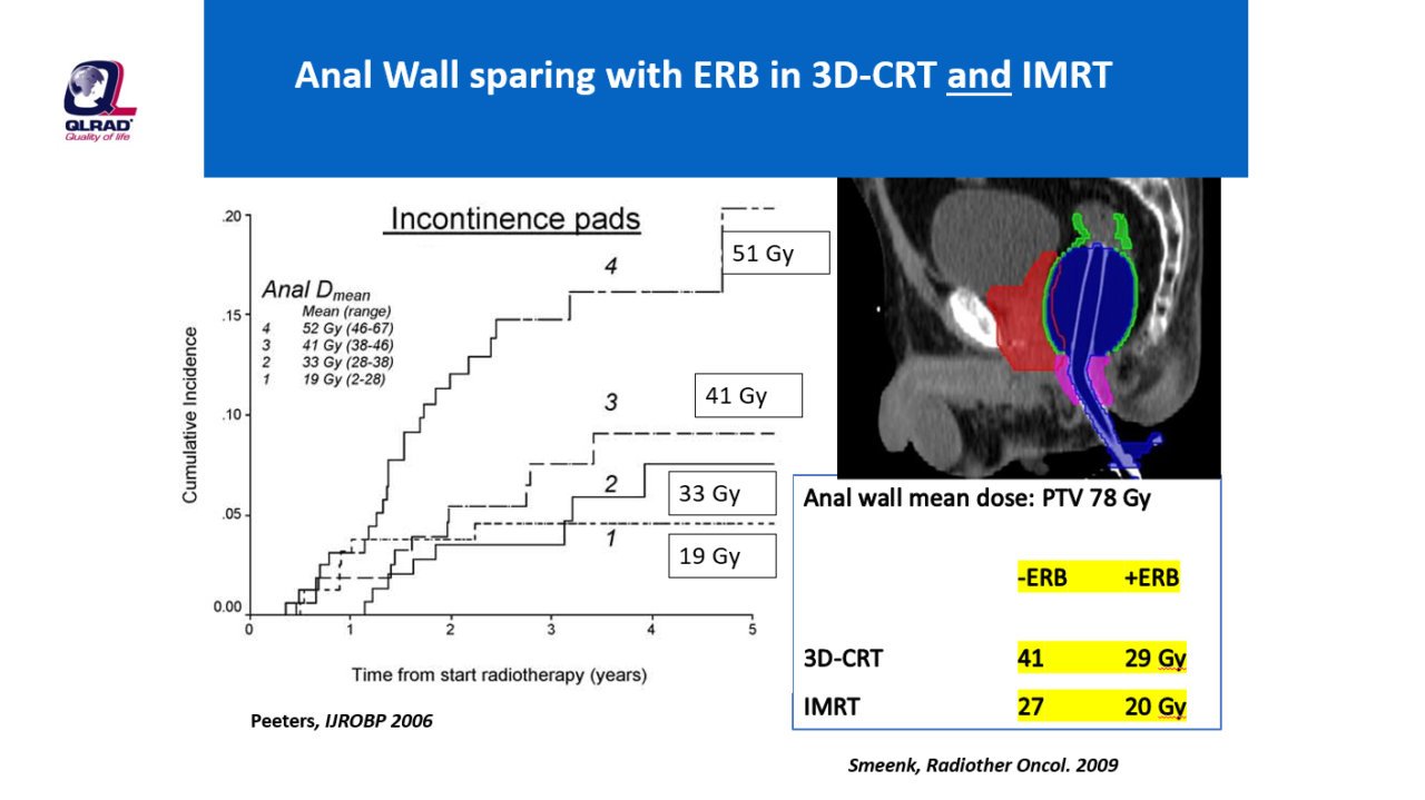 Endorectal Balloon Qlrad