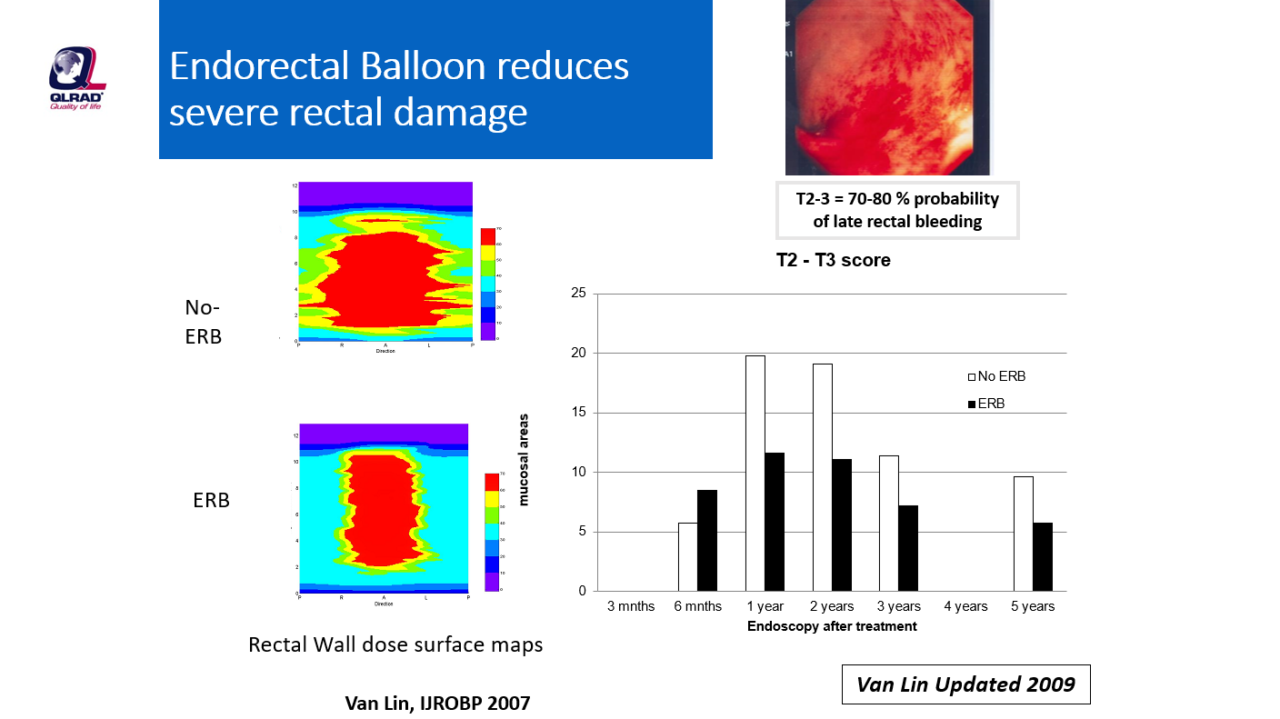 Endorectal Balloon Qlrad